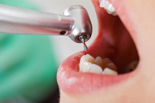 Best Emergency Broken Tooth Repair in Port Allegany, PA